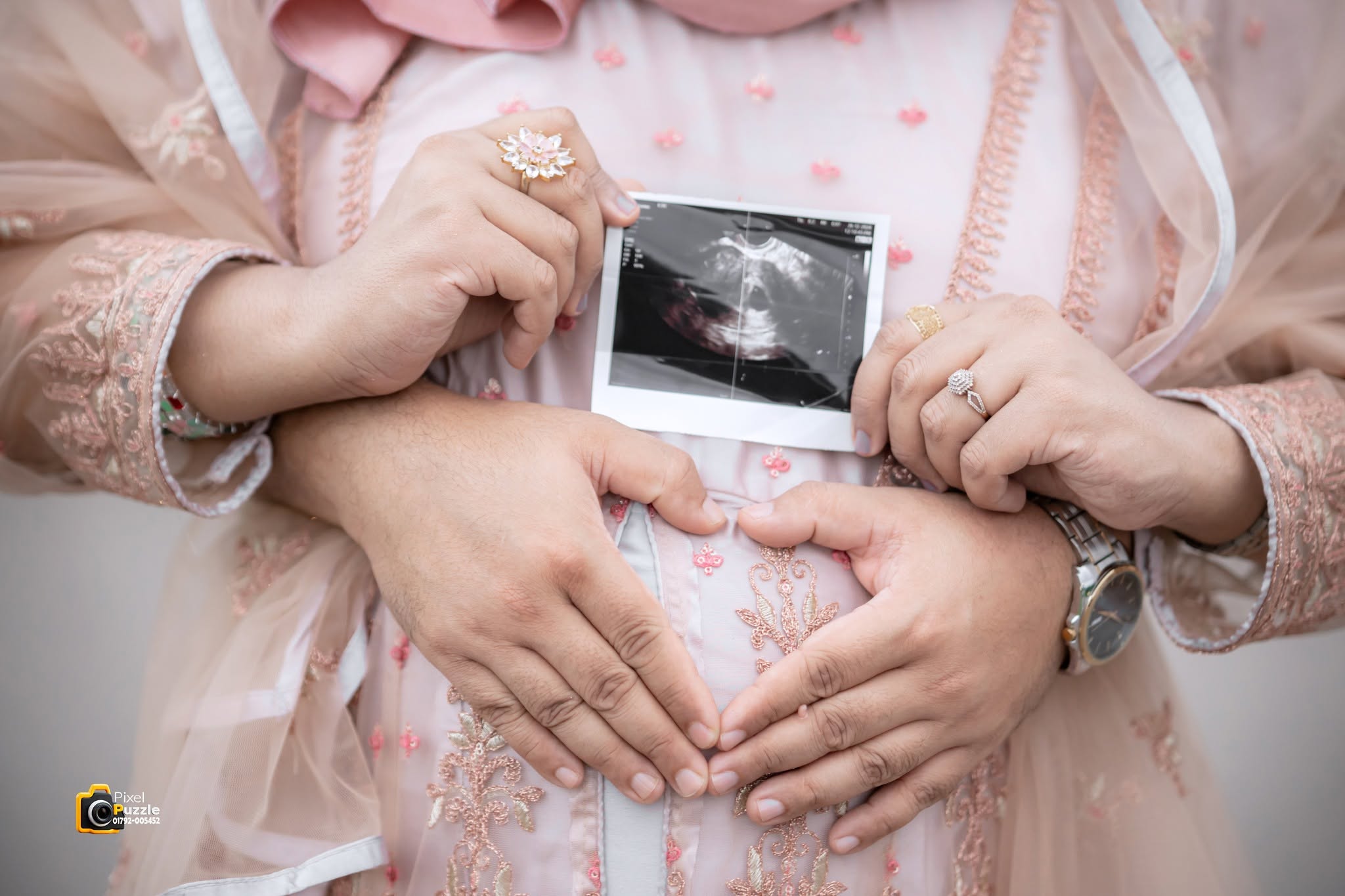 Parents holding an ultrasound photo over the baby bump